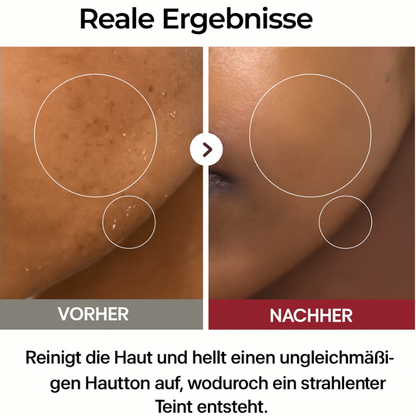 Dr. Melaxin – Rice Peel Shot Duo | Glow & Hautstruktur