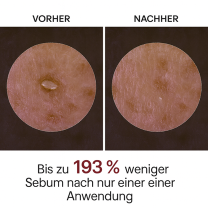 Dr. Melaxin – Rice Peel Shot Duo | Glow & Hautstruktur